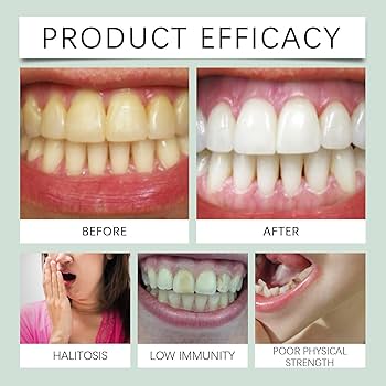 Benefits you can expect from using ProDentim daily